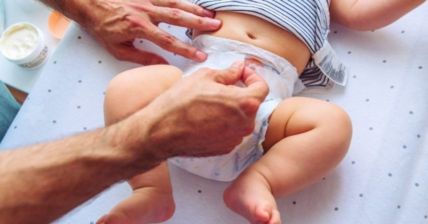 ¿Sabes qué es el Hidrocele y cómo puede afectar a tu bebé?